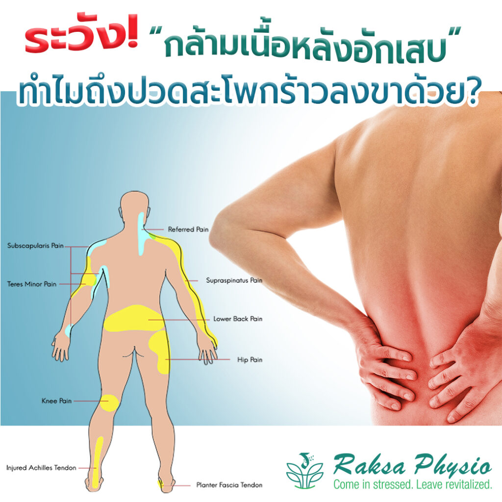 ปวดสะโพก ร้าวลงขา