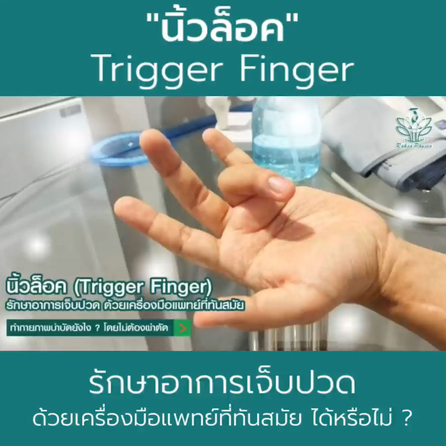 Trigger-Finger นิ้วล็อค