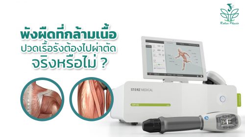Shock Wave เหมาะกับกลุ่มผู้ที่มีอาการแบบไหน