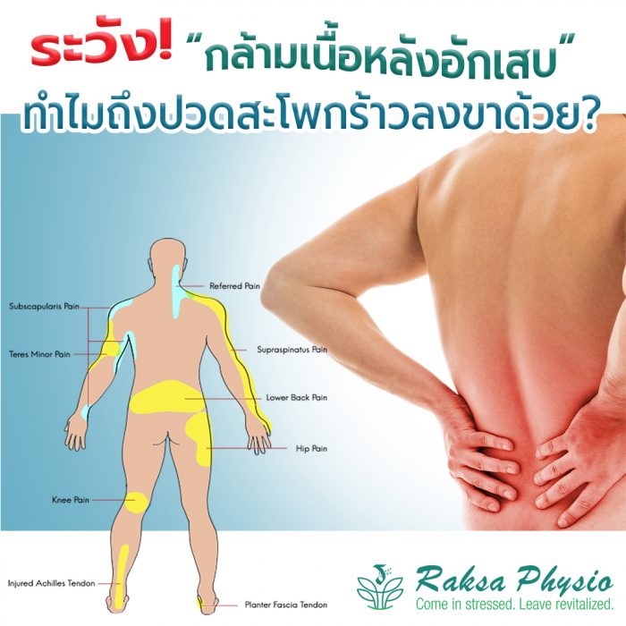 ปวดสะโพก ร้าวลงขา